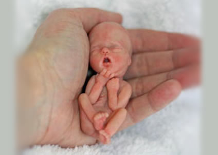 aborted_fetus